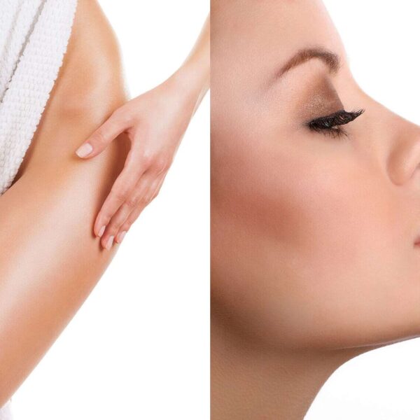 smartlipo Skin Tightening 14 1522x1141 1