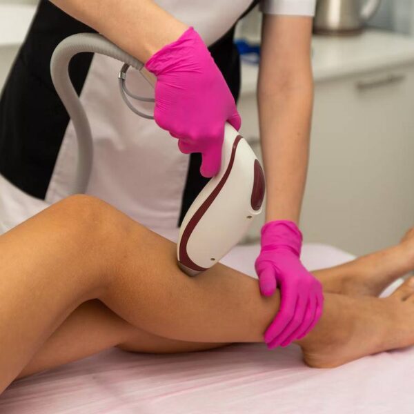 laser hair removal