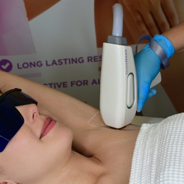 laser hair removal